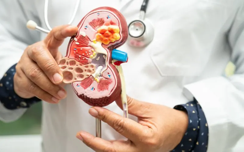 Nephrology Overview